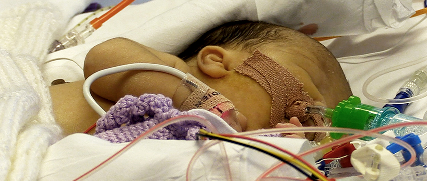 Platelet patient baby
